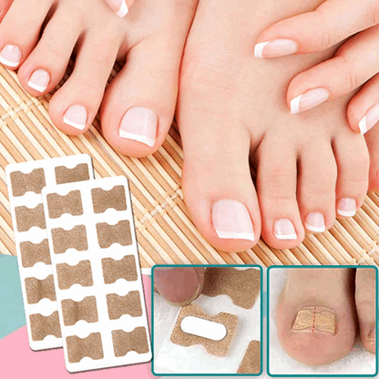 (50+50 GRATIS) FinePatches™ | Parche Correctores para Uñas Hermosas y Saludables | LA OFERTA TERMINA HOY