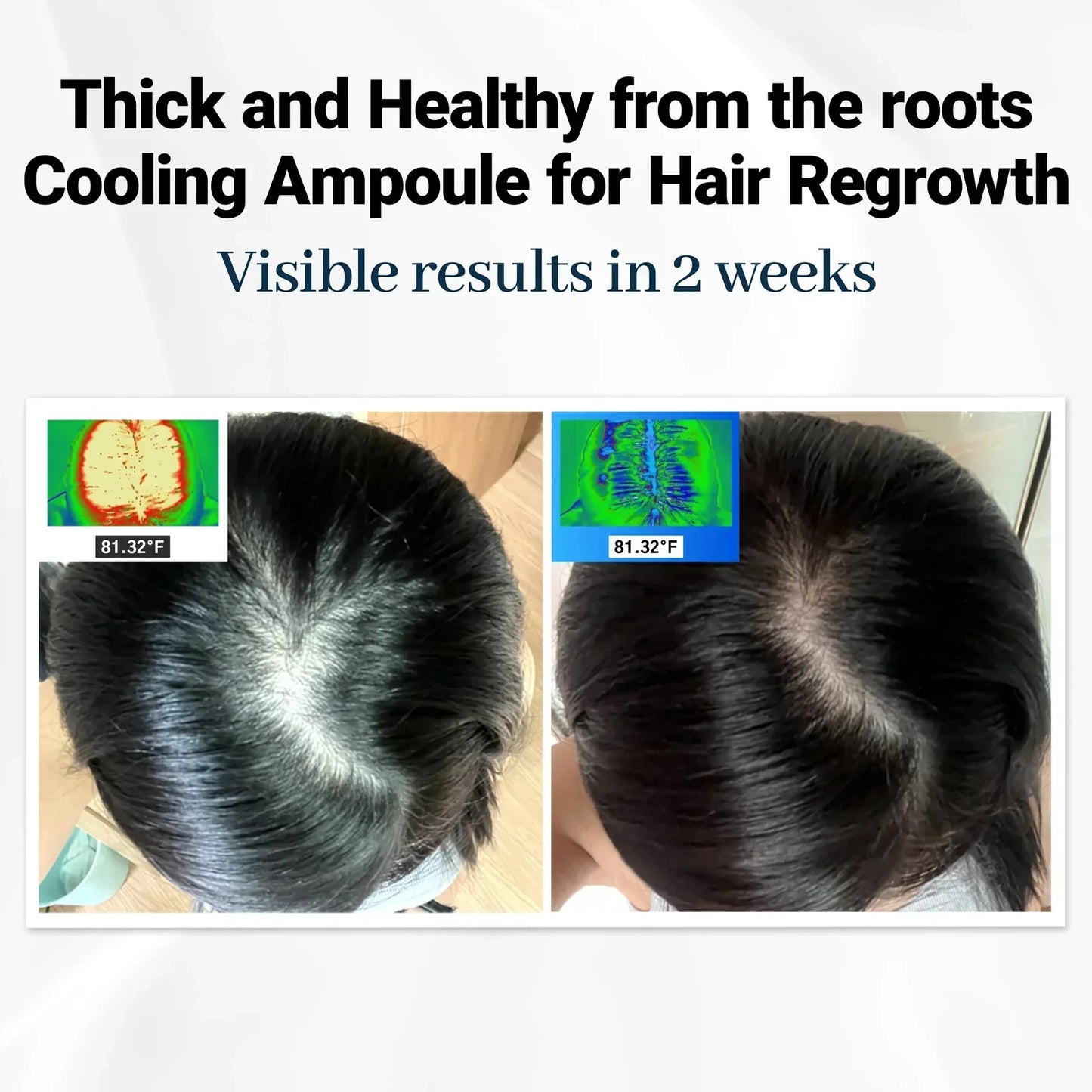 FolicleRevive™ - Avance coreano para el crecimiento del cabello que regenera el cabello perdido en solo 3 semanas