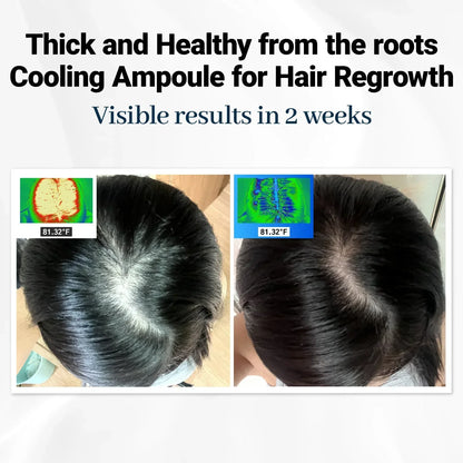 FolicleRevive™ - Avance coreano para el crecimiento del cabello que regenera el cabello perdido en solo 3 semanas