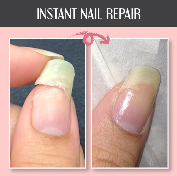 Gel reparador y protector para uñas: fortalece y regenera