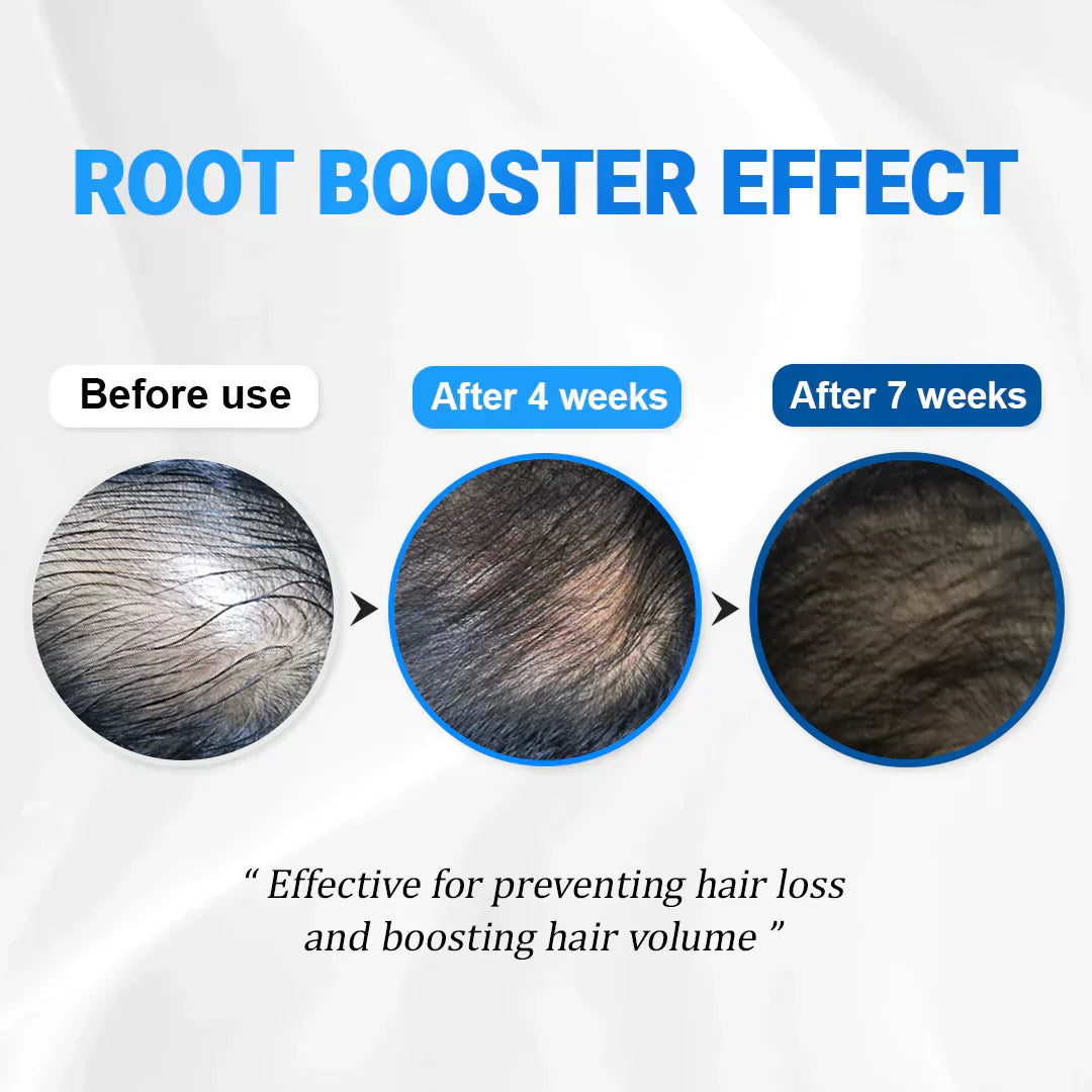 FolicleRevive™ - Avance coreano para el crecimiento del cabello que regenera el cabello perdido en solo 3 semanas