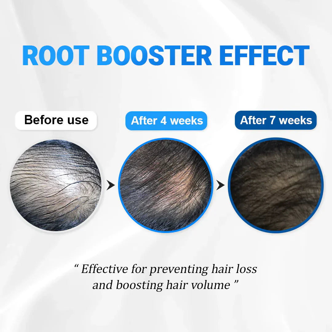 RootRevive™ - Ritrova i tuoi capelli folti e folti (anche se pensi che sia troppo tardi) 