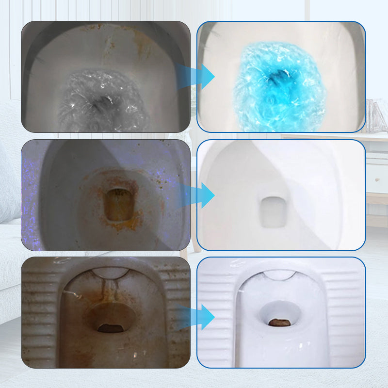 CleanEase Barra Desincrustante para Inodoros | Barra Concentrada Efectiva para Desincrustar Inodoros
