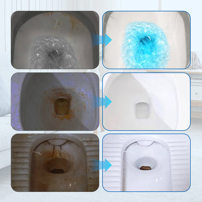 CleanEase Barra Desincrustante para Inodoros | Barra Concentrada Efectiva para Desincrustar Inodoros