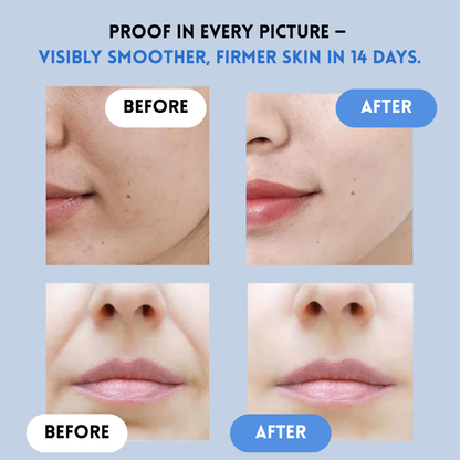 Tiras YouthLift™ Renew – La solución instantánea para una belleza atemporal