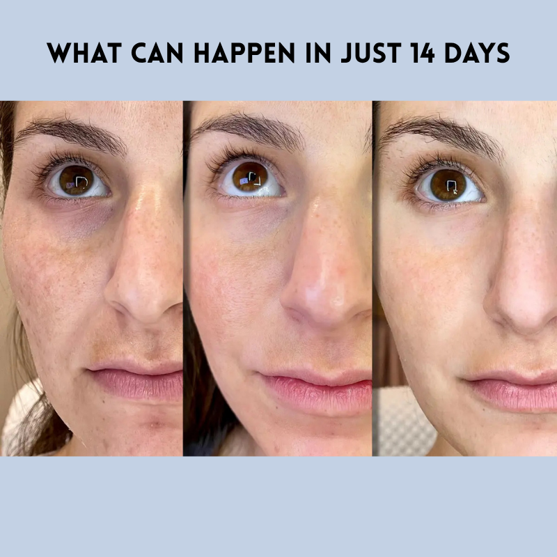 Tiras YouthLift™ Renew – La solución instantánea para una belleza atemporal