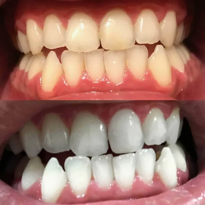 Color Correction Teeth Whitening Pen