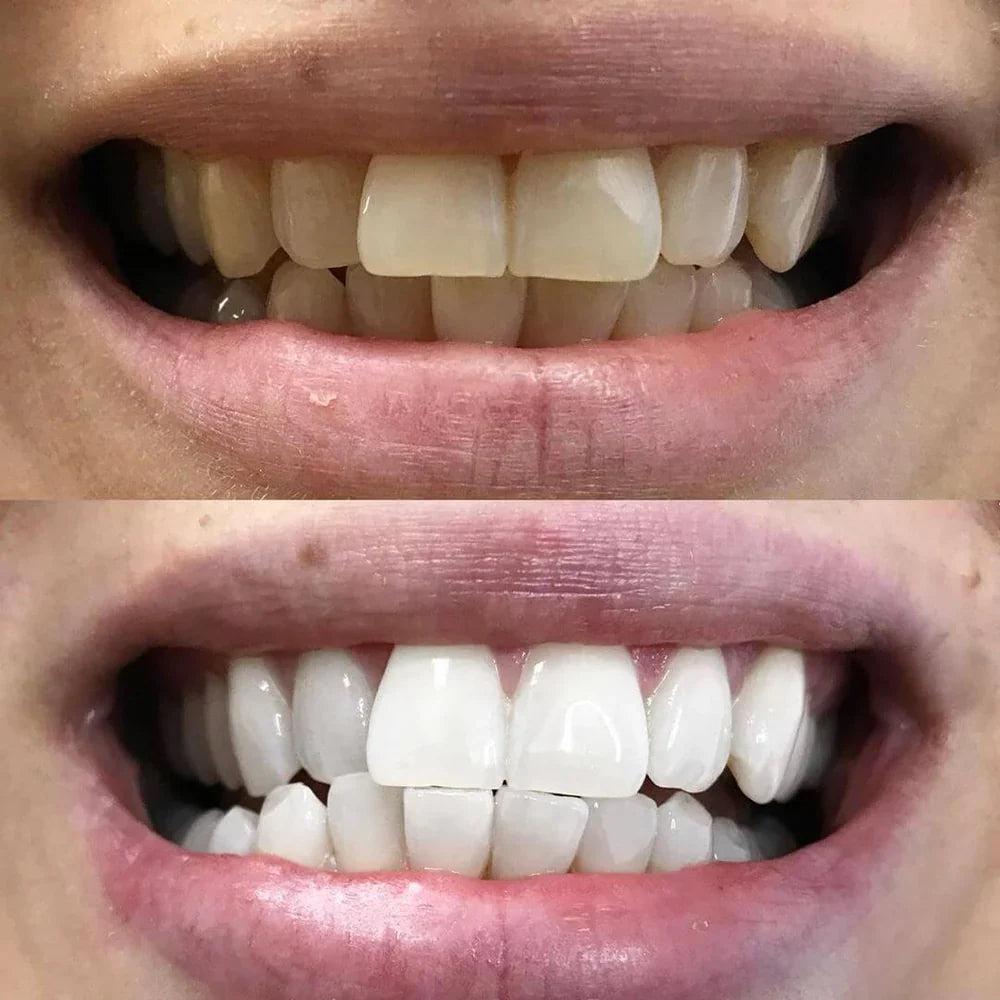 Color Correction Teeth Whitening Pen