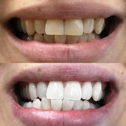 Color Correction Teeth Whitening Pen