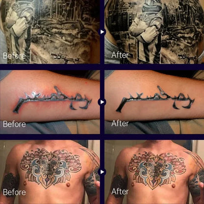 Bálsamo para el cuidado posterior del tatuaje