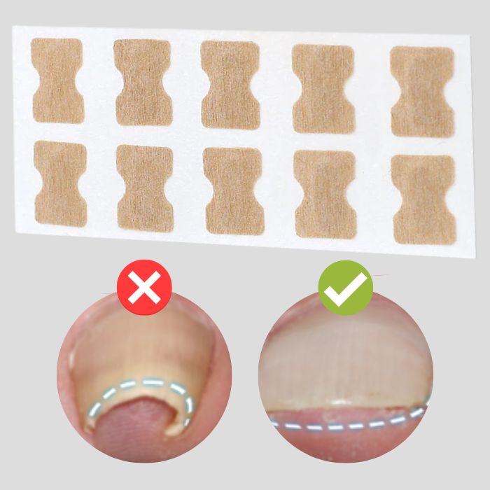 (50+50 GRATIS) FinePatches™ | Parche Correctores para Uñas Hermosas y Saludables | LA OFERTA TERMINA HOY