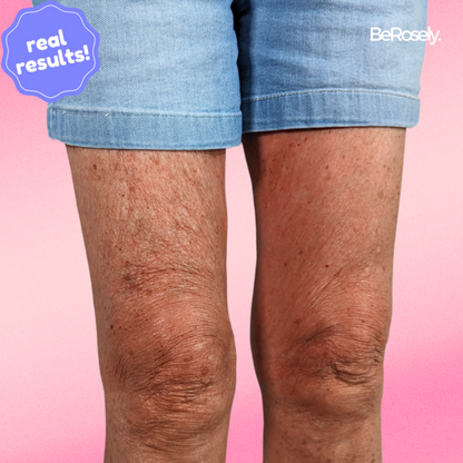 SilkSkin - Flawless Legs in Seconds (10+5 FREE | 20+10 FREE)