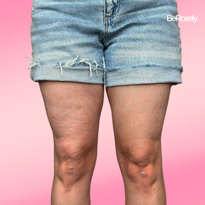 SilkSkin - Flawless Legs in Seconds (10+5 FREE | 20+10 FREE)