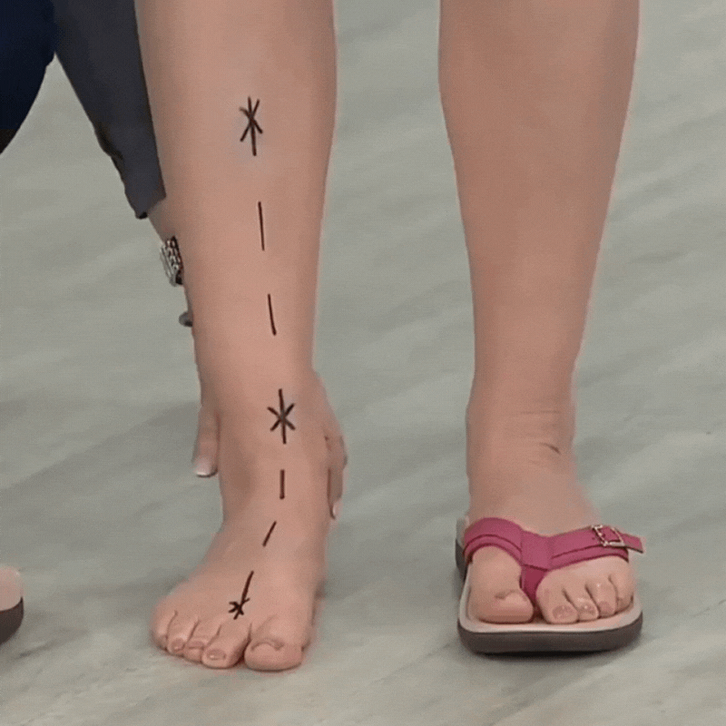 Sandalias ortopédicas de verano Pylera
