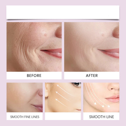 Cinta Invisible para Lifting Facial